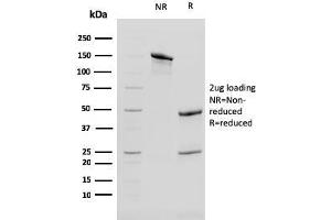 SDS-PAGE Analysis of Purified Cytokeratin 13 Mouse Monoclonal Antibody (KRT13/2213). (Cytokeratin 13 antibody)