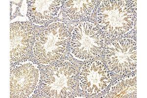 ABIN7095844 and ABIN7099906 at 1/100 staining rat testis tissue by IHC-P. (B4GALNT3 antibody)