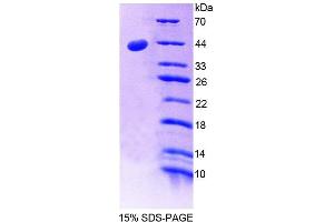 SDS-PAGE analysis of Mouse CD99 Protein.