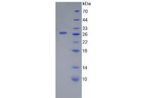 SDS-PAGE analysis of Human Galectin 12 Protein.