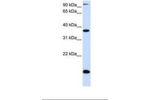 Image no. 1 for anti-Kruppel-Like Factor 8 (KLF8) (AA 74-123) antibody (ABIN6739064) (KLF8 antibody  (AA 74-123))