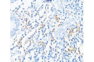 HLA-DRB3 antibody