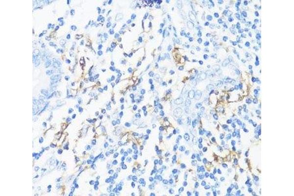 HLA-DRB3 antibody