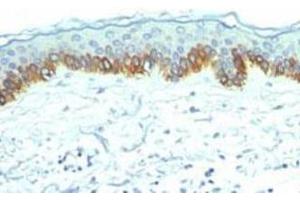 Immunohistochemical staining (Formalin-fixed paraffin-embedded sections) analysis of human skin with Cytokeratin, LMW monoclonal antibody, clone AE1  at 1:200 using peroxidase-conjugate and DAB chromogen. (Cytokeratin 1 antibody)