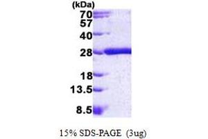 SDS-PAGE (SDS) image for GTPase Kras (KRAS) (AA 1-186) protein (His tag) (ABIN5852938) (K-RAS Protein (AA 1-186) (His tag))
