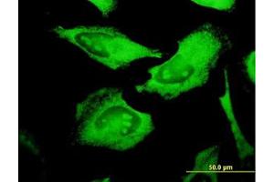 Image no. 1 for anti-Protein C Receptor, Endothelial (PROCR) (AA 1-239) antibody (ABIN599144) (PROCR antibody  (AA 1-239))