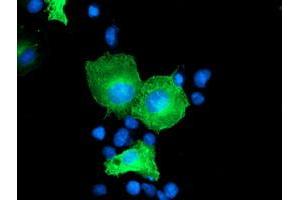 Anti-CCM2 mouse monoclonal antibody (ABIN2454949) immunofluorescent staining of COS7 cells transiently transfected by pCMV6-ENTRY CCM2 (RC201418). (CCM2 antibody)