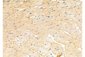 ABIN6259685 and ABIN6277180 at 1/100 staining Rat heart tissue by IHC-P. (ABCC4 antibody)