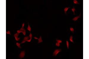 ABIN6275035 staining Hela by IF/ICC. (Complement Factor I antibody  (Internal Region))