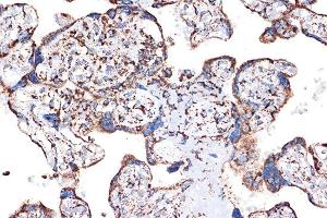 Immunohistochemistry of paraffin-embedded human placenta using HSPE1/HSP10/HSPE1/HSP10/CPN10 Rabbit mAb (ABIN7267567) at dilution of 1:100 (40x lens). (HSPE1 antibody)