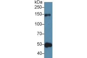 Western Blot; Sample: Human Urine; Primary Ab: 5µg/ml Rabbit Anti-Rat THBS1 Antibody Second Ab: 0. (Thrombospondin 1 antibody  (AA 71-259))