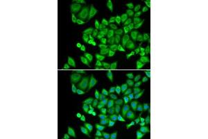 Immunofluorescence analysis of U2OS cells using DHRS9 antibody (ABIN6130324, ABIN6139603, ABIN6139604 and ABIN6221932). (DHRS9 antibody  (AA 18-319))