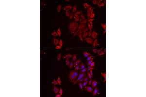 Immunofluorescence analysis of U2OS cells using PAICS antibody. (PAICS antibody  (AA 176-425))