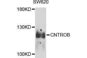 Western blot analysis of extracts of SW620 cells, using CNTROB antibody (ABIN5974543) at 1/1000 dilution. (CNTROB antibody)