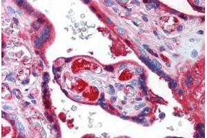 Human Placenta (formalin-fixed, paraffin-embedded) stained with TF antibody ABIN462368 followed by biotinylated anti-mouse IgG secondary antibody ABIN481714, alkaline phosphatase-streptavidin and chromogen. (Transferrin antibody  (N-Term))