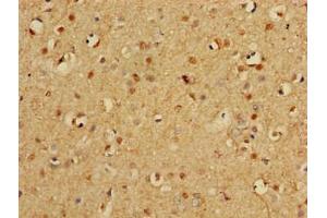 Immunohistochemistry of paraffin-embedded human brain tissue using ABIN7164952 at dilution of 1:100 (PSMA3 antibody  (AA 218-248))