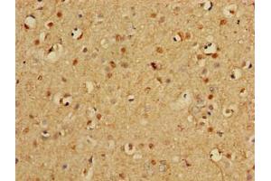 Immunohistochemistry of paraffin-embedded human brain tissue using ABIN7164952 at dilution of 1:100 (PSMA3 antibody  (AA 218-248))