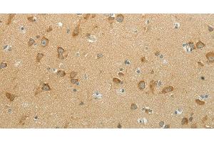 Immunohistochemistry of paraffin-embedded Human brain using NDRG3 Polyclonal Antibody at dilution of 1:70 (NDRG3 antibody)