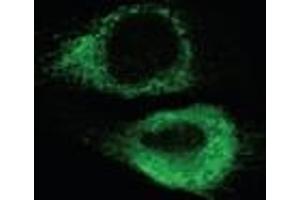 Immunofluorescence analysis of endoplasmic reticulum staining of mouse C2C12 myoblasts transfected with wild type mouse ADAM12 using KDEL (Grp78, Grp94) mAb (10C3). (KDEL antibody  (AA 649-654))