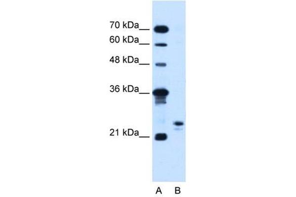 MOSPD3 antibody  (C-Term)