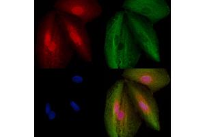 ABIN6259117 and ABIN6273494 staining  cells by IF/ICC.