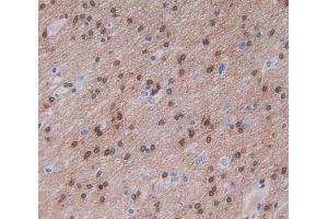 Used in DAB staining on fromalin fixed paraffin- embedded brain tissue (Nischarin antibody  (AA 1246-1346))