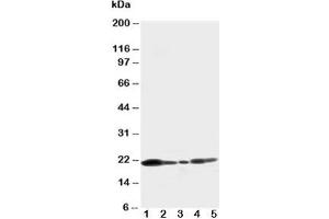 Western blot testing of Caveolin-1 antibody and Lane 1:  U87;  2: HeLa;  3: MCF-7;  4: A549;  5: HT1080 cell lysate (Caveolin-1 antibody  (C-Term))