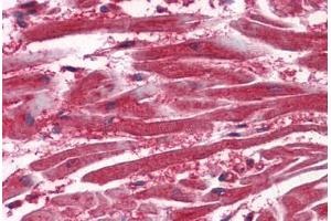 Anti-VEGFR-1 antibody IHC staining of human heart. (FLT1 antibody  (AA 1251-1338))