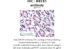 Image no. 1 for anti-Ras Responsive Element Binding Protein 1 (RREB1) antibody (ABIN1738965) (RREB1 antibody)