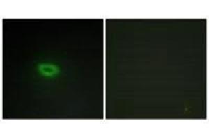 Immunofluorescence analysis of A549 cells, using ECRG4 antibody. (MEMO1 antibody)