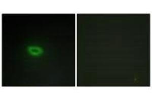 Immunofluorescence analysis of A549 cells, using ECRG4 antibody.