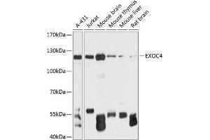 Western blot analysis of extracts of various cell lines, using EXOC4 antibody (ABIN6127883, ABIN6140366, ABIN6140367 and ABIN6215986) at 1:3000 dilution. (Sec8 antibody  (AA 1-280))