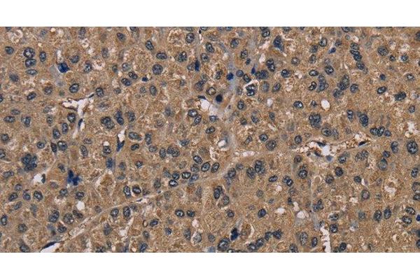 FGF7 antibody