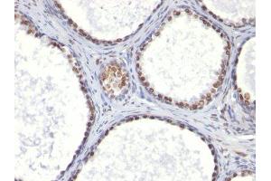 Image no. 1 for anti-Integrin Alpha2b (CD41) antibody (ABIN6156530) (Integrin Alpha2b antibody)