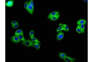 Immunofluorescence staining of HepG2 cells with ABIN7163983 at 1:66, counter-stained with DAPI.