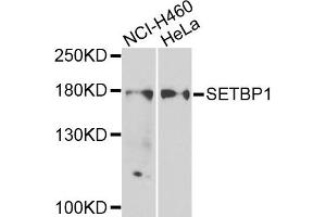 Western blot analysis of extracts of NCI-H460 and HeLa cells, using SETBP1 antibody.