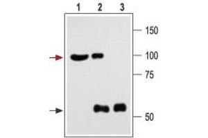 Immunoprecipitation of rat brain lysate: - 1. (KCNMA1 antibody  (C-Term, Intracellular))