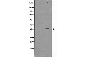 Western blot analysis on Jurkat cell lysate using NT5C3 Antibody,The lane on the left is treated with the antigen-specific peptide. (NT5C3 antibody  (N-Term))