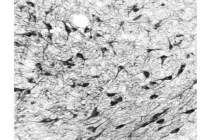 Immunohistochemistry (IHC) image for anti-8-Oxoguanine DNA Glycosylase (OGG1) (AA 1-100), (N-Term) antibody (ABIN363384) (OGG1 antibody  (N-Term))