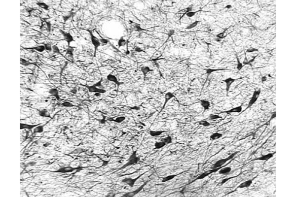 OGG1 antibody  (N-Term)