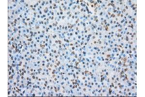 Immunohistochemical staining of paraffin-embedded colon tissue using anti-ERCC1 mouse monoclonal antibody. (ERCC1 antibody)