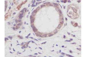 Image no. 1 for anti-Tumor Necrosis Factor alpha (TNF alpha) antibody (ABIN465030) (TNF alpha antibody)