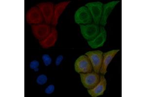 ABIN6259200 and ABIN6275528 staining Hela cells(45 min of heat-shock) by IF/ICC. (STK32C antibody  (Internal Region))