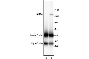 SMC4 antibody (pAb) tested by Immunoprecipitation. (SMC4 antibody  (N-Term))