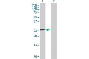 Western Blot analysis of SNURF expression in transfected 293T cell line by SNURF MaxPab polyclonal antibody. (SNURF antibody  (AA 1-240))