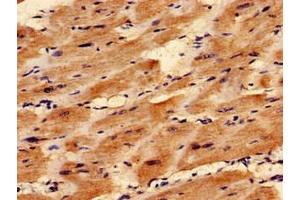 Immunocytochemistry analysis of human heart tissue using ABIN7171476 at dilution of 1:100 (TAZ antibody  (AA 95-262))
