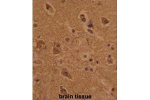 Immunohistochemistry (IHC) image for anti-CTD (Carboxy-terminal Domain, RNA Polymerase II, Polypeptide A) Phosphatase, Subunit 1 (CTDP1) antibody (ABIN3002722)