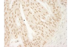 Immunohistochemistry (IHC) image for anti-Catenin (Cadherin-Associated Protein), delta 1 (CTNND1) (AA 75-125) antibody (ABIN7454706)