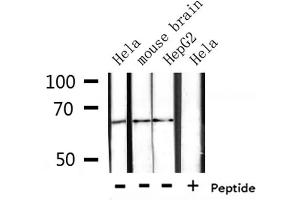 Western blot analysis of extracts from Hela, mouse brain, HepG2, using CTPS Antibody.