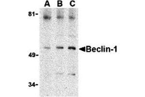 Western Blotting (WB) image for anti-Beclin 1, Autophagy Related (BECN1) (C-Term) antibody (ABIN1030289) (Beclin 1 antibody  (C-Term))